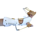 Radial-Palsy-Splint-001.webp