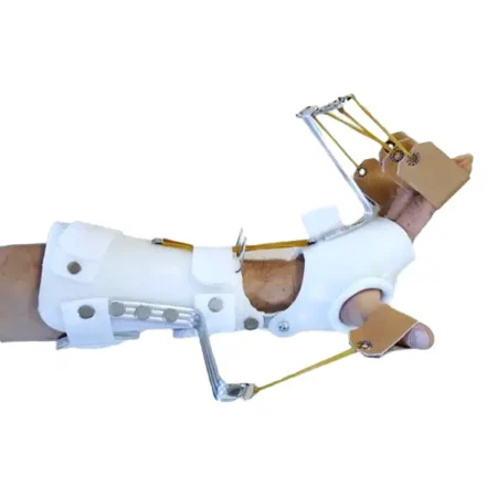 Radial Palsy Splint