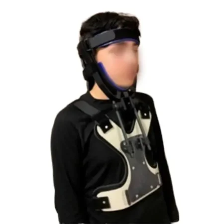 Pinless Halo Traction